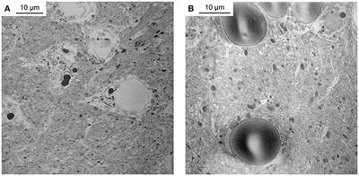 Fast Homogeneous En Bloc Staining of Large Tissue Samples for Volume Electron Microscopy